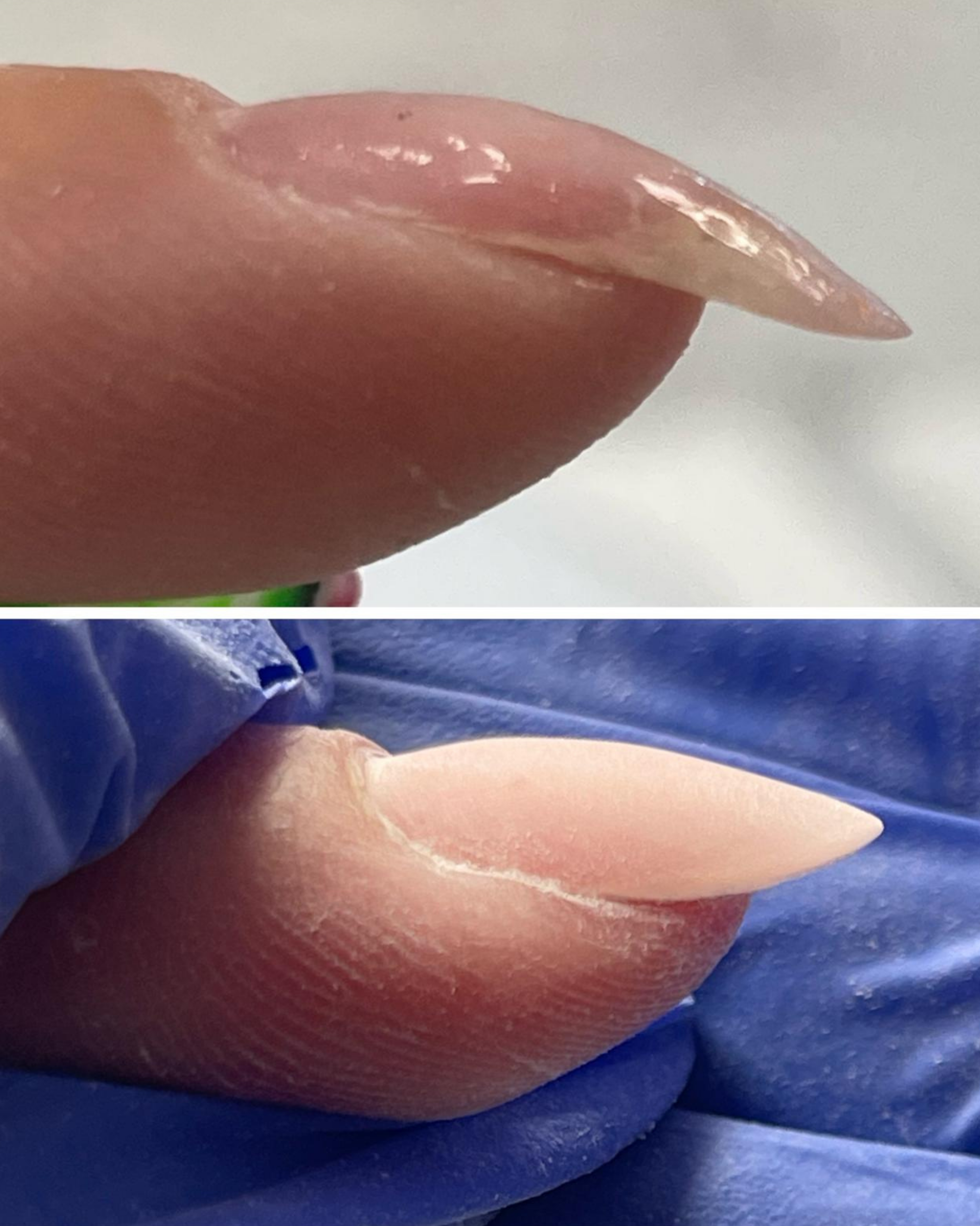 natural nail side profile showing nail architecture and structure for gel application – Twinz Nails