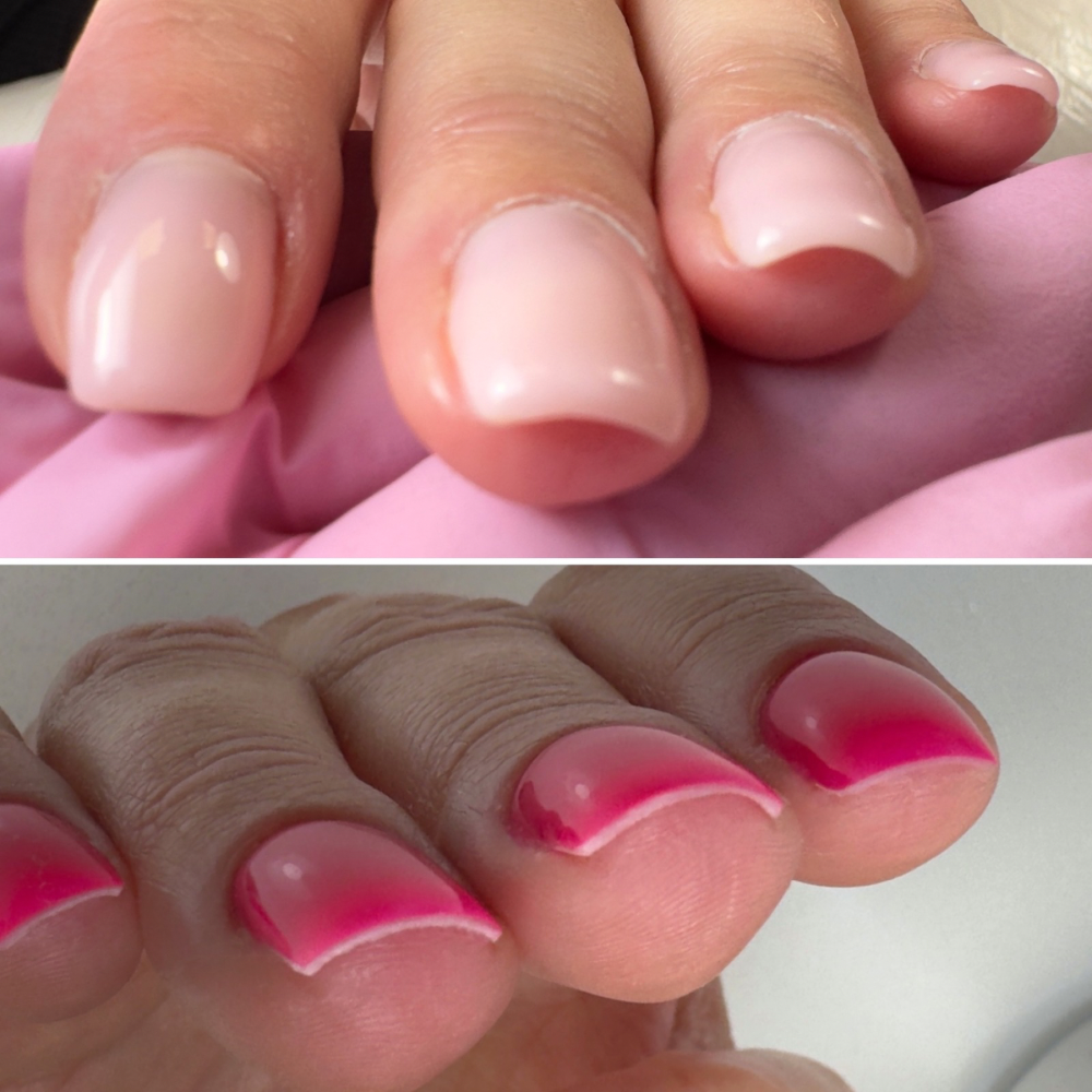Before - After Correction